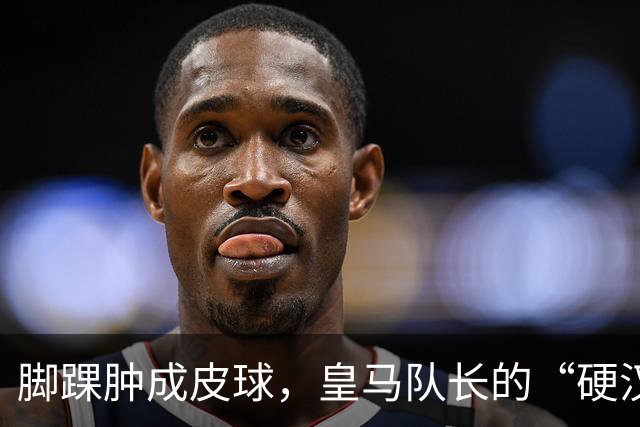 脚踝肿成皮球，皇马队长的“硬汉”剧本，该停了